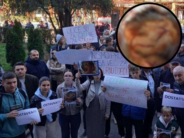 gorazde-na-nogama-nakon-napada-psa-lutalice-na-dijete-dosta-je-bilo-untitled-design-2025-10-29t123156-642_6901fb3fc6835