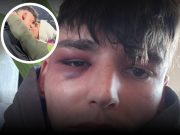 Pretučen sudac koji je zaprosio dečka pred 50.000 gledatelja u Bundesligi