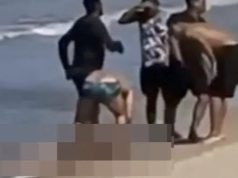 Dječaku (11) ajkula otkinula nogu: Molio spasioce da ne dozvole da umre!